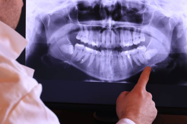 Best Broken Tooth Emergency  in Seneca, IL